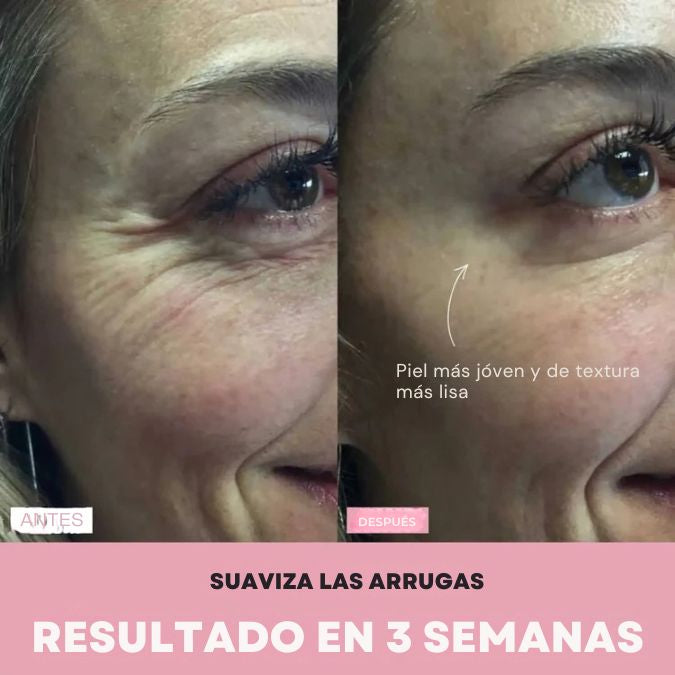MASAJEADOR FACIAL- REDUCTOR DE PAPADA - OJERAS - ARRUGAS - MANCHAS - ACNÉ