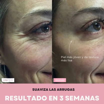 MASAJEADOR FACIAL- REDUCTOR DE PAPADA - OJERAS - ARRUGAS - MANCHAS - ACNÉ