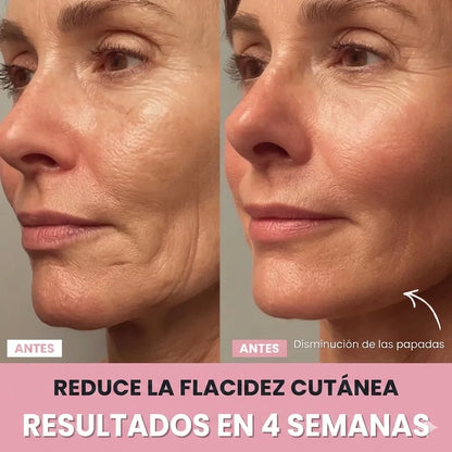 MASAJEADOR FACIAL- REDUCTOR DE PAPADA - OJERAS - ARRUGAS - MANCHAS - ACNÉ
