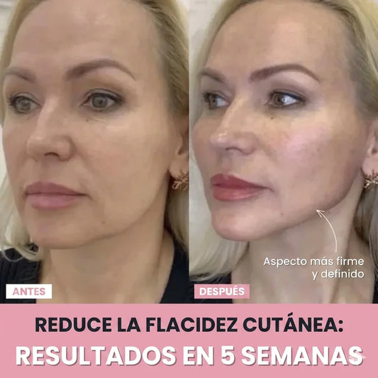 MASAJEADOR FACIAL- REDUCTOR DE PAPADA - OJERAS - ARRUGAS - MANCHAS - ACNÉ
